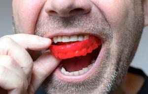 man putting a red mouthguard over his teeth