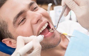 man's dental checkup