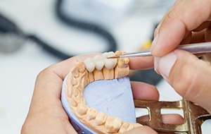 lab technician with dental bridge in Jacksonville 