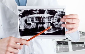 dental consultation