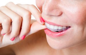What makes Invisalign in Jacksonville, FL, right for me?