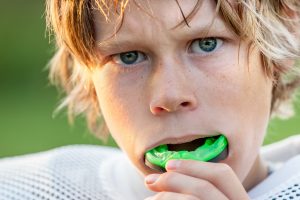 mouthguard for teeth protection