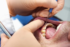 man open mouth dentist