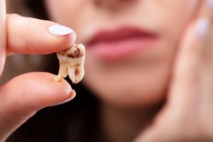 woman holding dead tooth